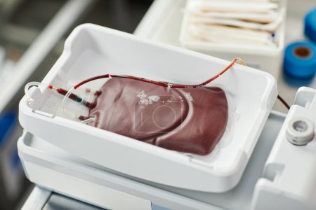 Foto de Vista superior del primer plano de la bolsa de sangre llena en bandeja en el centro de donación de sangre, espacio para copiar - Imagen libre de derechos