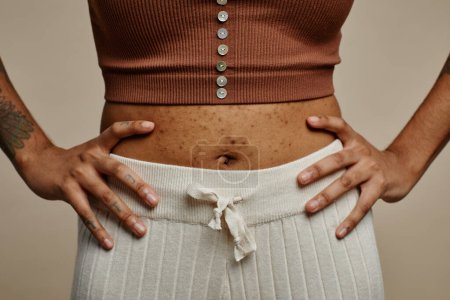 Photo for Close up of confident black woman showing off belly with real skin texture and acne scars - Royalty Free Image