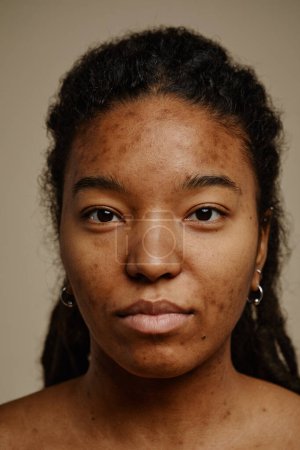 Téléchargez les photos : Portrait vertical rapproché d'une jeune femme ethnique regardant la caméra, mettant l'accent sur la texture réelle de la peau et les cicatrices d'acné sur le visage - en image libre de droit