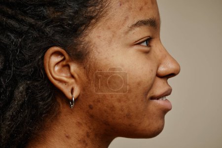 Téléchargez les photos : Portrait minime de jeune femme ethnique souriant avec des cicatrices d'acné sur le visage et des piercings d'oreille - en image libre de droit