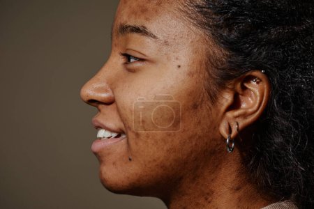 Téléchargez les photos : Gros plan portrait de femme noire souriante avec des cicatrices d'acné sur le visage, se concentrer sur la texture réelle de la peau, l'espace de copie - en image libre de droit