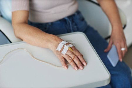 Foto de Primer plano de la mano femenina con goteo intravenoso durante la sesión de tratamiento en la clínica, espacio para copiar - Imagen libre de derechos