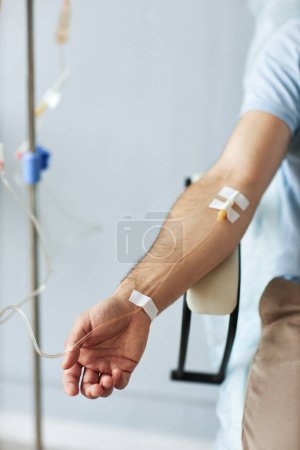 Foto de Primer plano vertical de la mano masculina con perfusión intravenosa por goteo en sesión de tratamiento en la clínica - Imagen libre de derechos