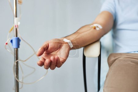 Foto de Primer plano mínimo del brazo masculino con perfusión intravenosa por goteo en sesión de tratamiento en la clínica - Imagen libre de derechos