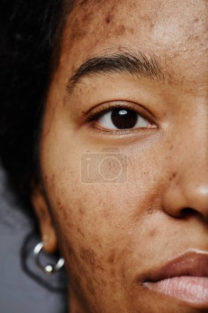 Téléchargez les photos : Demi plan gros plan de jeune femme noire sans maquillage regardant la caméra - en image libre de droit