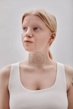Photo for Minimal portrait of ethereal blonde girl with albinism posing against white background - Royalty Free Image