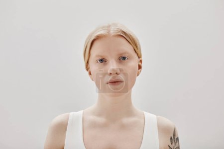 Minimal portrait of ethereal woman with albinism looking at camera against white background