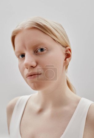 Vertical portrait of ethereal girl with albinism looking at camera against white