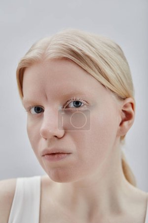 Close up portrait of ethereal young woman with albinism looking at camera against white background