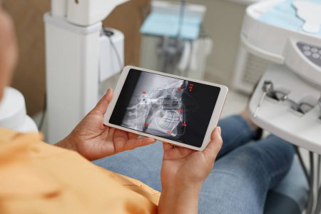 Téléchargez les photos : Gros plan de la femme tenant une tablette numérique avec une image de radiographie dentaire à la clinique dentaire, espace de copie - en image libre de droit