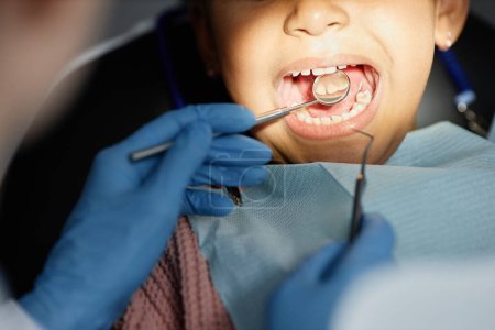 Photo for Top view closeup of little child in teeth checkup at dental clinic with dentist holding tools and mirror, copy space - Royalty Free Image
