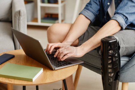 Close up of unrecognizable man with prosthetic leg using laptop at home and typing, copy space