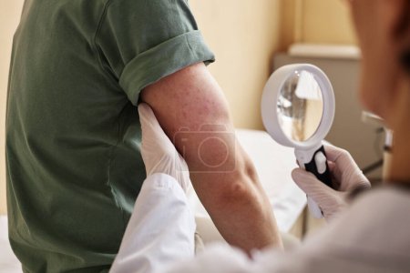 Foto de Primer plano del médico inspeccionando la piel con lupa mientras examina al paciente en la clínica de dermatología - Imagen libre de derechos