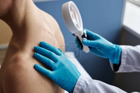Foto de Vista lateral de primer plano del médico utilizando lupa y examinando la espalda del paciente masculino en la clínica de dermatología - Imagen libre de derechos