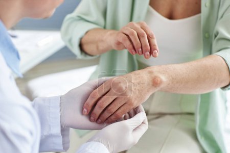 Téléchargez les photos : Gros plan du médecin inspectant une éruption cutanée sur la main d'une patiente dans une clinique de dermatologie, espace de copie - en image libre de droit