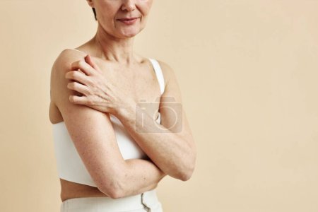 Téléchargez les photos : Gros plan minimal de femme mature grattant la peau nue souffrant d'allergies ou d'anxiété, espace de copie - en image libre de droit