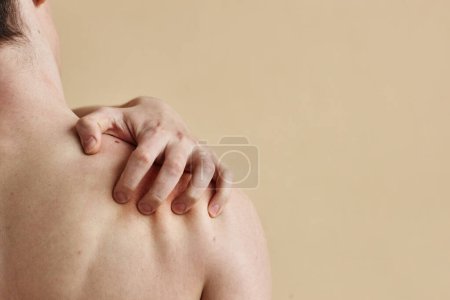 Foto de Primer plano del hombre irreconocible rascando desnudo contra fondo beige, espacio de copia - Imagen libre de derechos