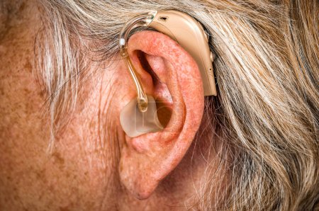 Photo for Hearing aid in the ear of aged old woman. Healthcare and medical theme - Royalty Free Image