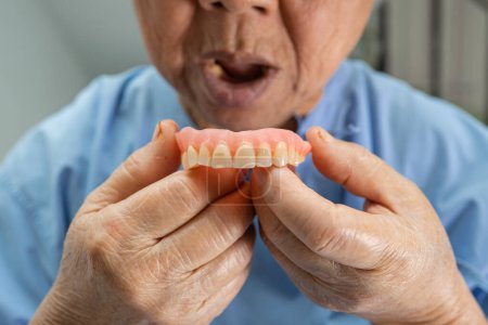Téléchargez les photos : Aînée asiatique ou vieille femme âgée patient tenant à utiliser une prothèse dentaire dans la salle d'hôpital de soins infirmiers, concept médical fort sain - en image libre de droit