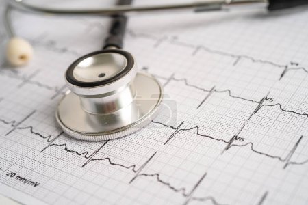 Estetoscopio en electrocardiograma ECG, onda cardíaca, ataque cardíaco, informe de cardiograma.