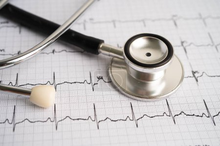 Stéthoscope sur électrocardiogramme ECG, onde cardiaque, crise cardiaque, rapport cardiogramme.