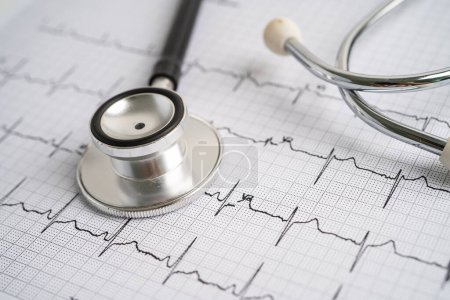 Foto de Estetoscopio en electrocardiograma ECG, onda cardíaca, ataque cardíaco, informe de cardiograma. - Imagen libre de derechos