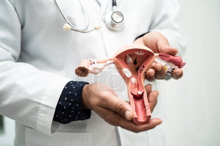 Photo for Uterus, doctor holding anatomy model for study diagnosis and treatment in hospital. - Royalty Free Image
