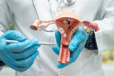 Utérus, médecin tenant le modèle d'anatomie pour le diagnostic d'étude et le traitement à l'hôpital.