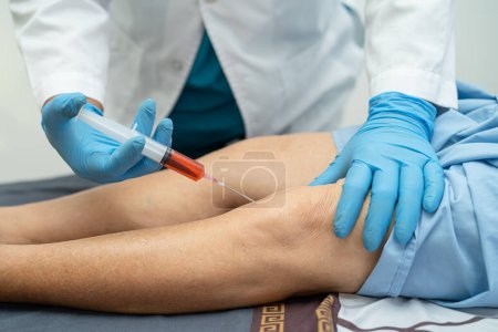 Téléchargez les photos : Asiatique médecin injecter de l'acide hyaluronique plaquettes plasma riche dans le genou de la femme âgée de marcher sans douleur. - en image libre de droit