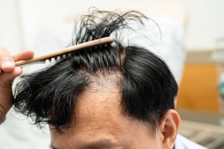 Téléchargez les photos : Chauve à l'avant de la tête et commencer sans perte de cheveux glabre de mature asiatique affaires smart bureau actif homme. - en image libre de droit