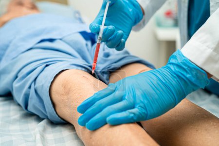 Asiatische Arzt injizieren Hyaluronsäure Thrombozytenreiches Plasma in das Knie der Seniorin zu gehen, ohne Schmerzen.