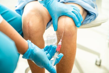 Foto de Médico asiático inyectar plasma rico en plaquetas de ácido hialurónico en la rodilla de la mujer mayor para caminar sin dolor. - Imagen libre de derechos