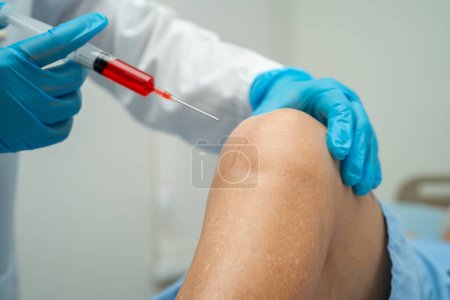 Photo for Asian elderly woman patient show her scars surgical total knee joint replacement Suture wound surgery arthroplasty in hospital, healthy strong medical concept. - Royalty Free Image