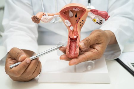 Utérus, médecin avec modèle d'anatomie pour le diagnostic de l'étude et le traitement à l'hôpital.