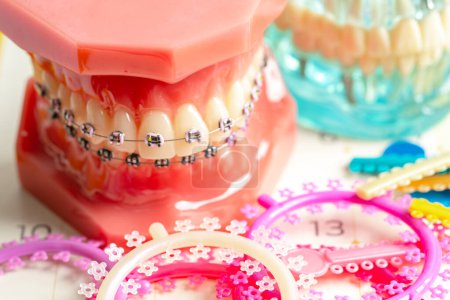 Anneaux et attaches de ligatures orthodontiques, élastiques élastiques sur orthèses orthodontiques, modèle pour dentiste étudiant la dentisterie.