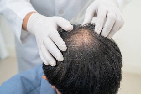 Doctor checkup and treatment Asian man baldness hair problem patient.