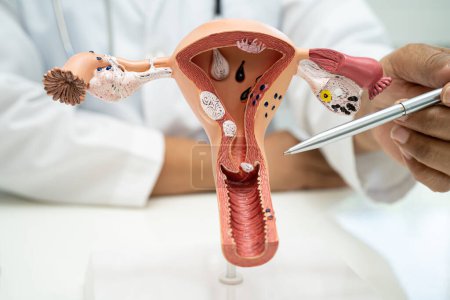 Uterus, doctor with anatomy model for study diagnosis and treatment in hospital.