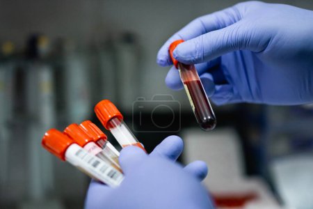 Photo for Gloved hands holding several bottles of blood ampoules with a laboratory background - Royalty Free Image