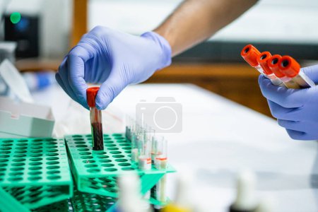 Photo for Hands wear gloves put blood sample ampoule bottles onto shelves in the lab - Royalty Free Image