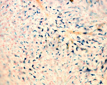 Foto de Las células Kupffer son macrófagos del hígado. El hierro coloidal actúa como una mancha vital que se puede introducir en el cuerpo siendo fagocitado por las células de Kupffer, que se marcan en azul con la reacción de Perls. - Imagen libre de derechos