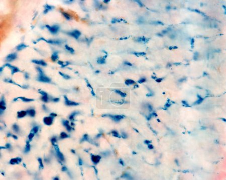Téléchargez les photos : Les cellules de Kupffer sont des macrophages du foie. Le fer colloïdal agit comme une tache vitale qui peut être introduite dans le corps phagocyté par les cellules de Kupffer, qui deviennent marquées en bleu avec la réaction de Perls.. - en image libre de droit