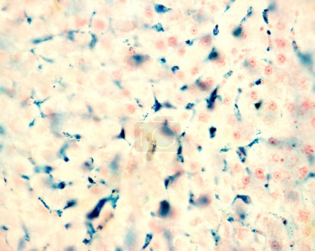 Téléchargez les photos : Les cellules de Kupffer sont des macrophages du foie. Le fer colloïdal agit comme une tache vitale qui peut être introduite dans le corps phagocyté par les cellules de Kupffer, qui deviennent marquées en bleu avec la réaction de Perls.. - en image libre de droit