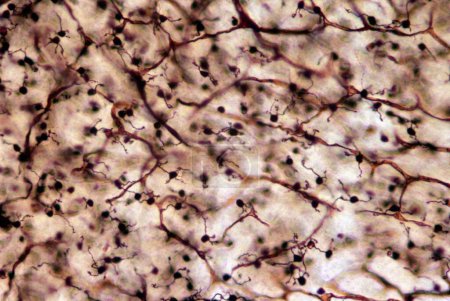 Foto de Células de gránulos cerebelosos, micrografía ligera. Capa granular cerebelosa teñida con cromato de plata Golgi que muestra la abundancia de células granulares. Tienen un soma redondeado muy pequeño con tres a cinco dendritas, que termina en una ampliación llamada dendr - Imagen libre de derechos