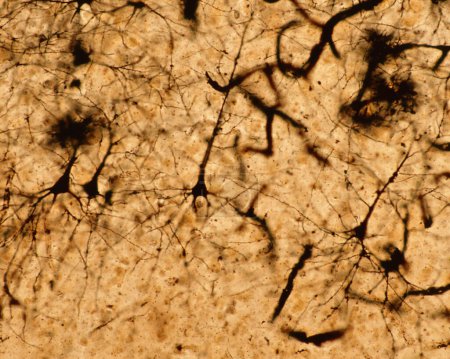 Photo for Pyramidal neurons of the cerebral cortex stained with the Golgi silver chromate. From the conic shaped soma, a large apical dendrite and multiple basal dendrites originate. - Royalty Free Image