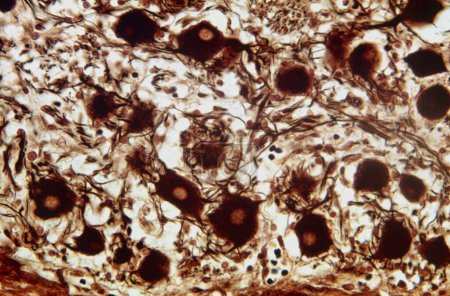 Foto de Micrografía ligera de ganglio simpático autónomo teñido con nitrato de plata de Cajal que muestra una mezcla de cuerpos celulares neuronales multipolares y fibras nerviosas. - Imagen libre de derechos