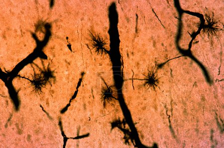 Photo for Protoplasmic astrocytes. They are located in the grey matter and have numerous processes, almost all of the same length and one more longer called end foot, ending on a blood vessel. The thick black strokes are blood vessels. Silver chromate Golgi me - Royalty Free Image