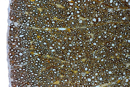 Foto de Materia blanca de la médula espinal que muestra fibras nerviosas mielinizadas de sección transversal teñidas con tetroxida de osmio para mostrar la vaina de mielina de las fibras nerviosas. Microscopio de luz. - Imagen libre de derechos
