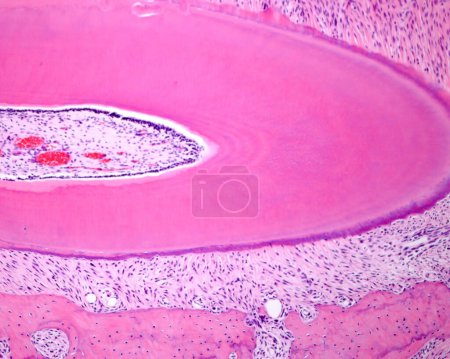 Photo for Cross section (slightly oblique) of a tooth root showing from the left border: dental pulp, row of odontoblast cell bodies, predentine, dentin, acellular cementum, periodontal ligament and alveolar bone. - Royalty Free Image