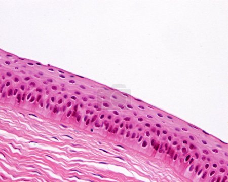 Foto de Epitelio de córnea, micrografía ligera. La córnea del ojo está revestida por un epitelio escamoso estratificado no queratinizado delgado con altas capacidades de renovación y regeneración. Bajo el epitelio, hay una fina capa de Bowman y el estroma corneal. - Imagen libre de derechos