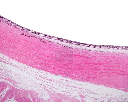 Foto de Microscopio de luz de muy bajo aumento de la pared del globo ocular que muestra, de abajo hacia arriba, la episclera, la esclerótica, la lámina fusca pigmentada y la coroides vascular y pigmentada del ojo. - Imagen libre de derechos